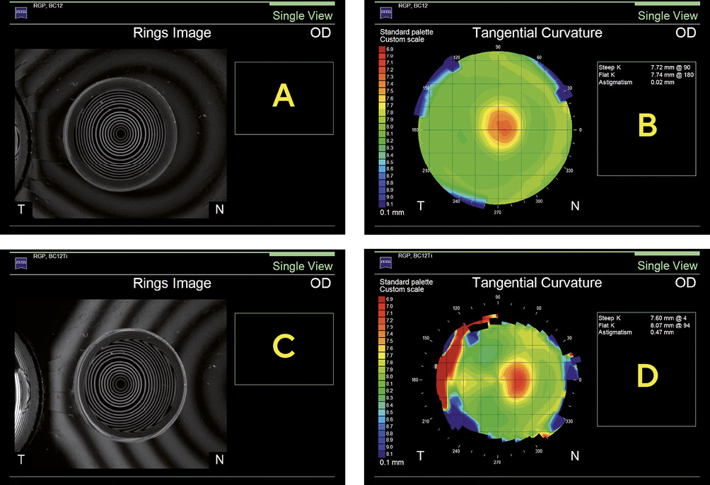 Lens Checking How Eye Care Practitioners Verify And Inspect Rigid Contact Lenses Ocl